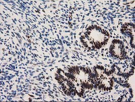 m03221 1 anti nmnat1 mouse monoclonal antibody clone id oti1g4 ihc testing 5
