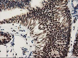 m03221 1 anti nmnat1 mouse monoclonal antibody clone id oti1g4 ihc testing 6