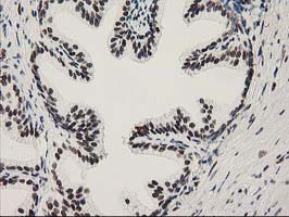 m03221 1 anti nmnat1 mouse monoclonal antibody clone id oti1g4 ihc testing 7