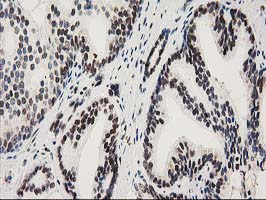 m03221 1 anti nmnat1 mouse monoclonal antibody clone id oti1g4 ihc testing 8