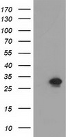 HEK293T cells were transfected with the pCMV6-ENTRY control (Left lane) or pCMV6-ENTRY NMNAT1 (Right lane) cDNA for 48 hrs and lysed