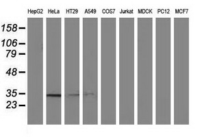 Western blot analysis of extracts (35ug) from 9 different cell lines by using anti-NMNAT1 monoclonal antibody