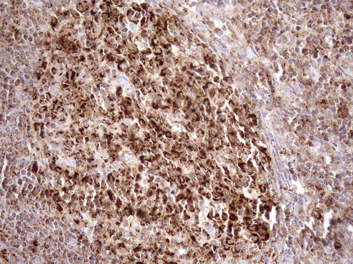 m03233 anti shmt2 mouse monoclonal antibody clone id oti3e9 ihc testing 10
