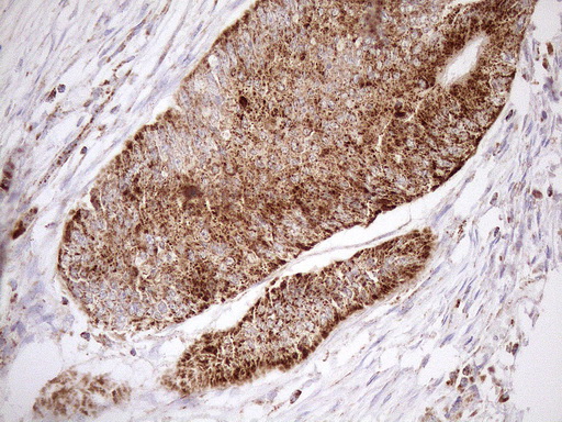 m03233 anti shmt2 mouse monoclonal antibody clone id oti3e9 ihc testing 11