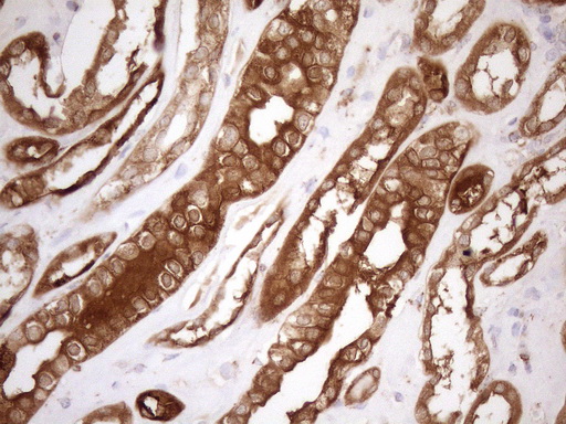 m03233 anti shmt2 mouse monoclonal antibody clone id oti3e9 ihc testing 12