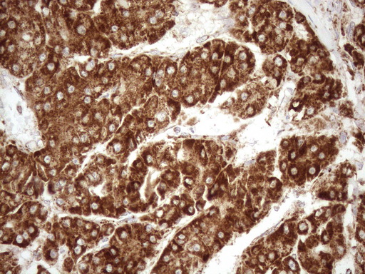 m03233 anti shmt2 mouse monoclonal antibody clone id oti3e9 ihc testing 13