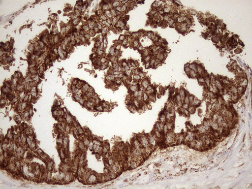 m03233 anti shmt2 mouse monoclonal antibody clone id oti3e9 ihc testing 2