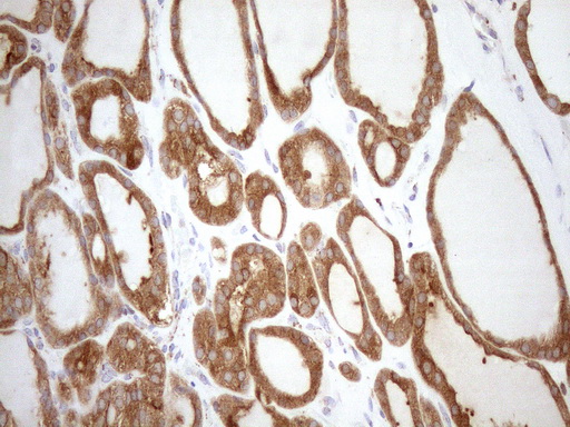 m03233 anti shmt2 mouse monoclonal antibody clone id oti3e9 ihc testing 4