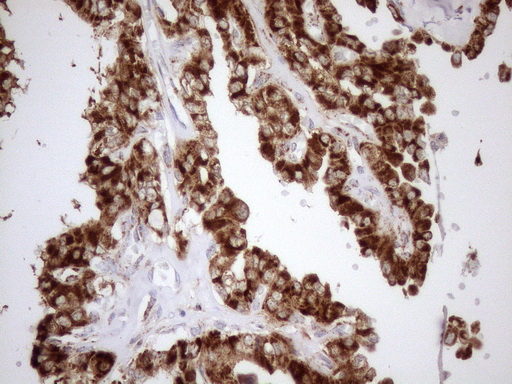 m03233 anti shmt2 mouse monoclonal antibody clone id oti3e9 ihc testing 5