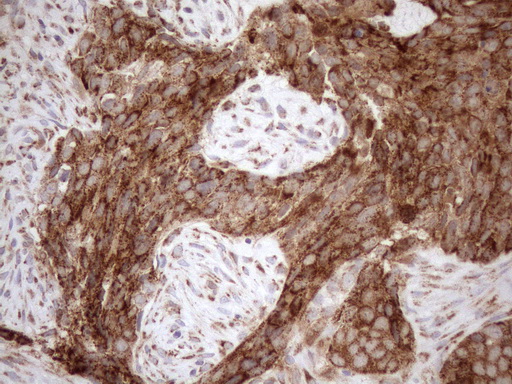 m03233 anti shmt2 mouse monoclonal antibody clone id oti3e9 ihc testing 6