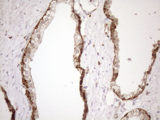 m03233 anti shmt2 mouse monoclonal antibody clone id oti3e9 ihc testing 7