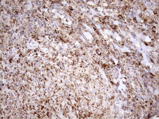 m03233 anti shmt2 mouse monoclonal antibody clone id oti3e9 ihc testing 8