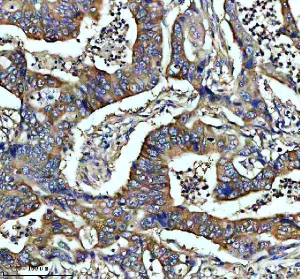 m03241 2 camk2a b d g primary antibodies ihc testing 1