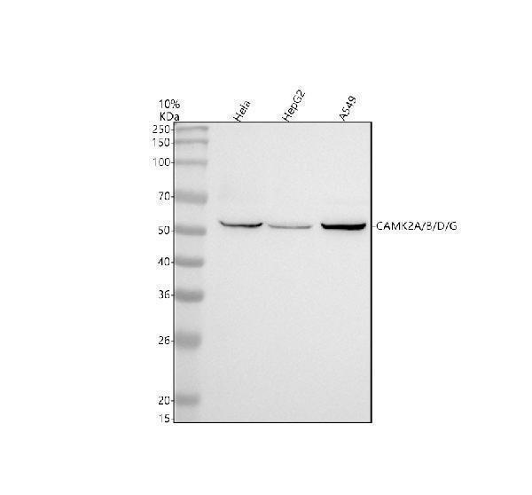 m03241 2 camk2abdg primary antibodies wb testing 1