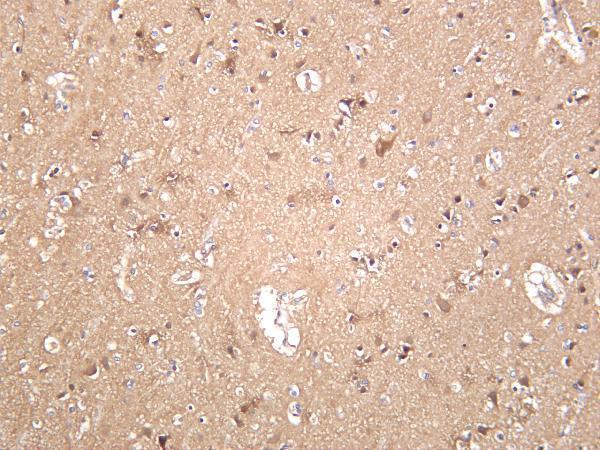 Human brain was stained with anti-CaMKII α rabbit antibody