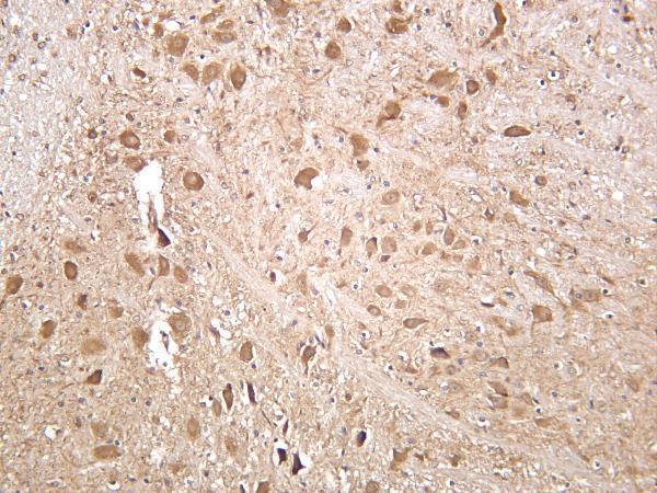 Mouse brain was stained with anti-CaMKII α rabbit antibody