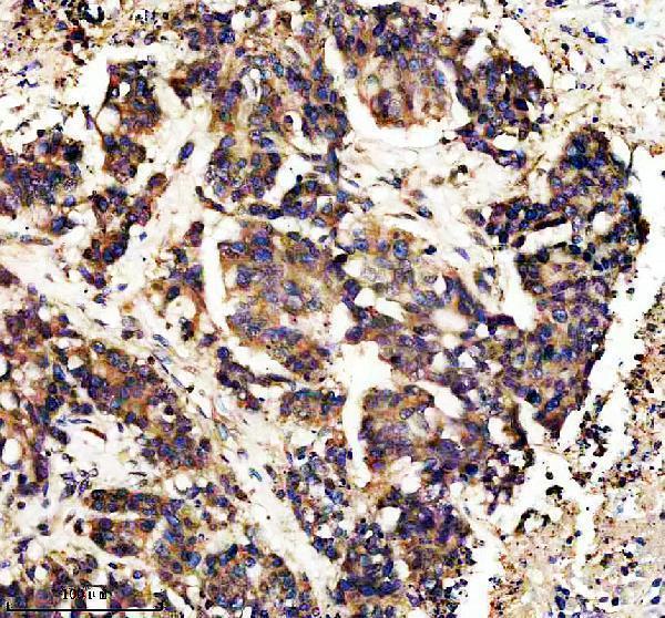IHC analysis of CAMK2A using anti-CAMK2A antibody (M03241)