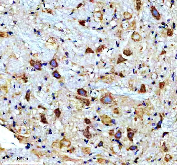IHC analysis of CAMK2A using anti-CAMK2A antibody (M03241)