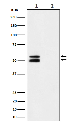 Western blot analysis of Phospho-CaMKII alpha (T286) expression in Mouse brain treated with Lambda phosphatase cell lysate