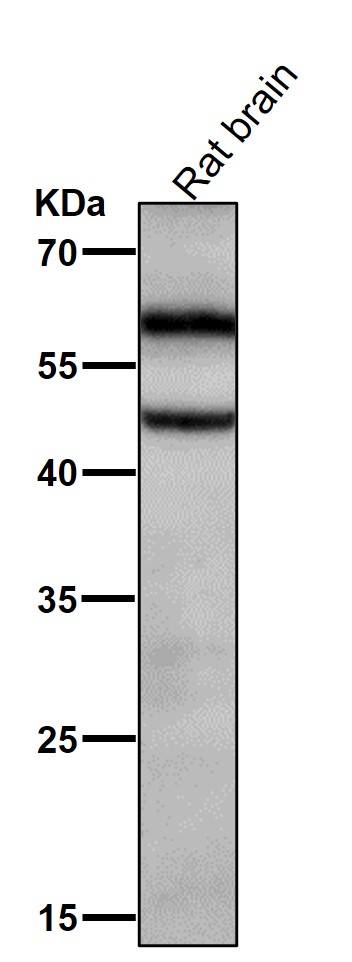All lanes use the Antibody at 1:2K dilution for 1 hour at room temperature