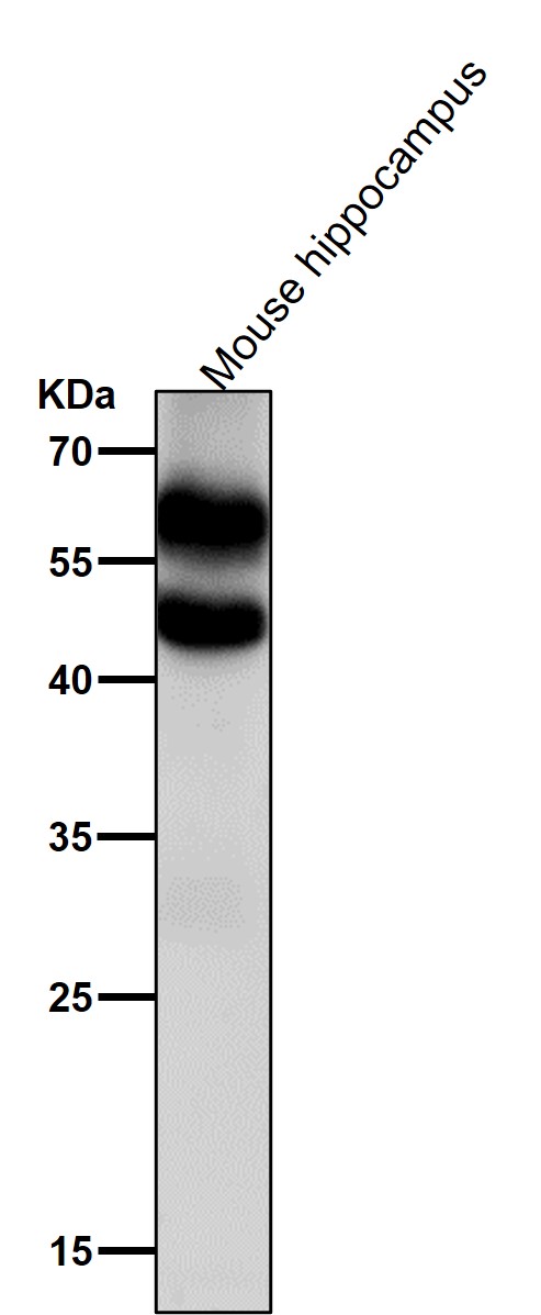 All lanes use the Antibody at 1:2K dilution for 1 hour at room temperature