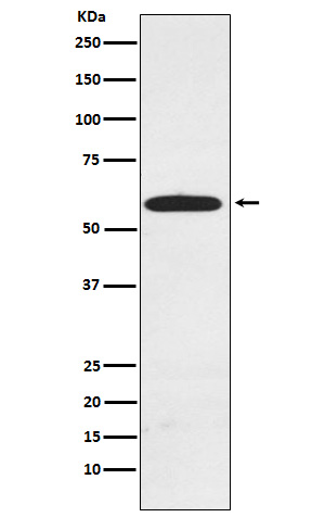 Western blot analysis of RAD23A expression in MCF7 cell lysate