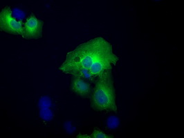 m03245 1 anti acat2 mouse monoclonal antibody clone id oti5f7 if testing 13
