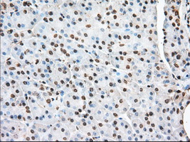 m03245 1 anti acat2 mouse monoclonal antibody clone id oti5f7 ihc testing 4