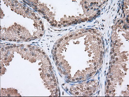m03245 1 anti acat2 mouse monoclonal antibody clone id oti5f7 ihc testing 5