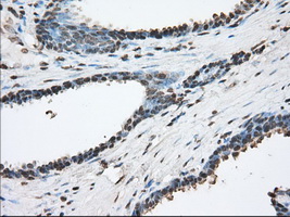 m03245 1 anti acat2 mouse monoclonal antibody clone id oti5f7 ihc testing 6