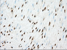 m03245 1 anti acat2 mouse monoclonal antibody clone id oti5f7 ihc testing 7