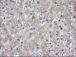 m03245 1 anti acat2 mouse monoclonal antibody clone id oti5f7 ihc testing 8