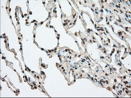m03245 1 anti acat2 mouse monoclonal antibody clone id oti5f7 ihc testing 9