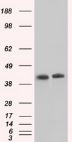 HEK293T cells were transfected with the pCMV6-ENTRY control (Left lane) or pCMV6-ENTRY ACAT2 (Right lane) cDNA for 48 hrs and lysed