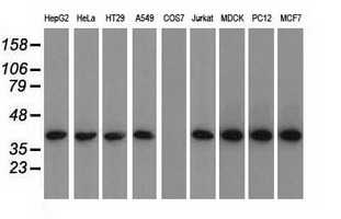 Western blot analysis of extracts (35ug) from 9 different cell lines by using anti-ACAT2 monoclonal antibody