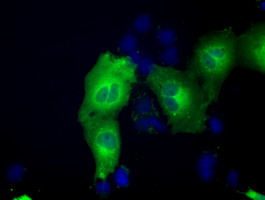 m03245 anti acat2 mouse monoclonal antibody clone id oti1b7 if testing 12
