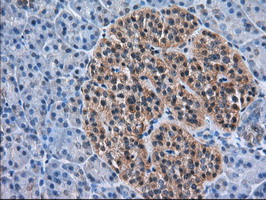 m03245 anti acat2 mouse monoclonal antibody clone id oti1b7 ihc testing 5