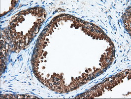 m03245 anti acat2 mouse monoclonal antibody clone id oti1b7 ihc testing 6