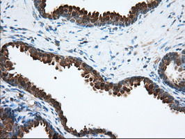 m03245 anti acat2 mouse monoclonal antibody clone id oti1b7 ihc testing 7