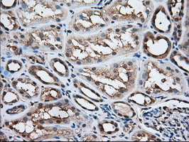 m03245 anti acat2 mouse monoclonal antibody clone id oti1b7 ihc testing 8