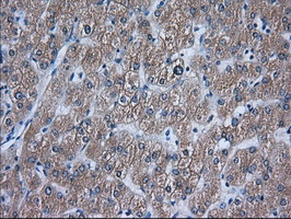 m03245 anti acat2 mouse monoclonal antibody clone id oti1b7 ihc testing 9