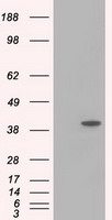 HEK293T cells were transfected with the pCMV6-ENTRY control (Left lane) or pCMV6-ENTRY ACAT2 (Right lane) cDNA for 48 hrs and lysed