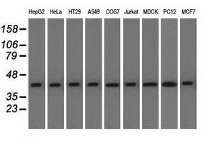 Western blot analysis of extracts (35ug) from 9 different cell lines by using anti-ACAT2 monoclonal antibody