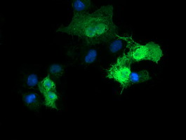 m03255 anti parvin alpha parva mouse monoclonal antibody clone id oti1c11 if testing 7