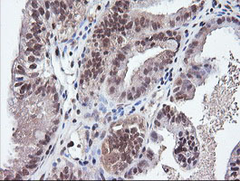 m03255 anti parvin alpha parva mouse monoclonal antibody clone id oti1c11 ihc testing 3