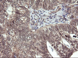 m03255 anti parvin alpha parva mouse monoclonal antibody clone id oti1c11 ihc testing 5