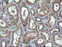 m03255 anti parvin alpha parva mouse monoclonal antibody clone id oti1c11 ihc testing 6