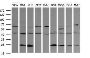 m03255 anti parvin alpha parva mouse monoclonal antibody clone id oti1c11 wb testing 2
