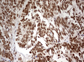 m03258 anti tif1 alpha trim24 mouse monoclonal antibody clone id oti2d9 ihc testing 3