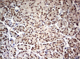 m03258 anti tif1 alpha trim24 mouse monoclonal antibody clone id oti2d9 ihc testing 4